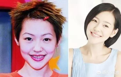 姚笛整容前:哪个明星整牙前最丑整牙等于整容么