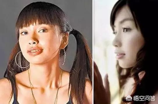 姚笛整容前:哪个明星整牙前最丑整牙等于整容么
