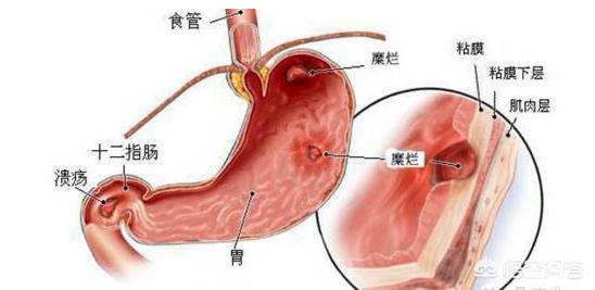 有慢性胃炎,吃什么养胃？
