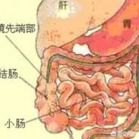 慢性胃肠炎:慢性胃肠炎专用药 慢性结肠炎的症状是肚脐眼疼吗？