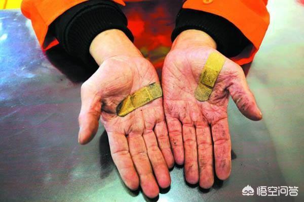 头条问答 - 金华浦江一环卫工人手被塑料瓶中倒出化学品强酸腐蚀,你