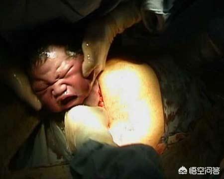 男子活剖孕狗拍视频无删减:怀孕4个月➕2周了，第一胎，没有结婚，还可以打掉吗？有多疼？