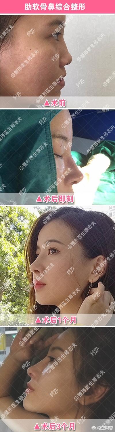 韩佳人图片:为什么很多女生正脸漂亮，侧脸却一般呢？
