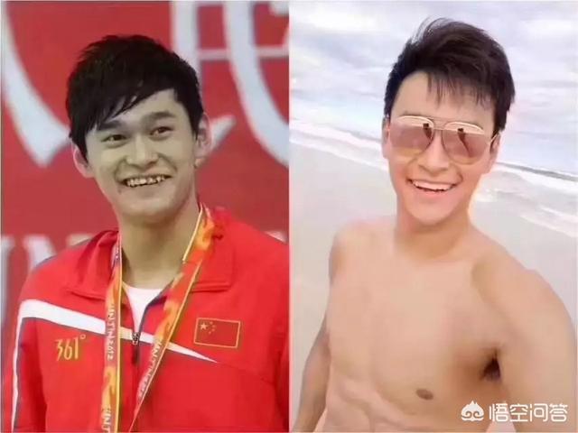 姚笛整容前:哪个明星整牙前最丑整牙等于整容么