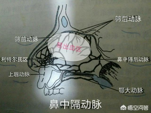 鼻血不止(鼻血一直流止不住是什么原因)