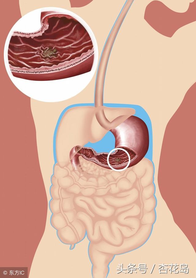 胃和十二指肠的位置图图片