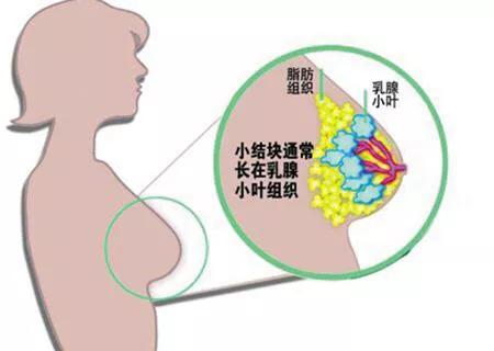哺乳时乳腺炎的症状是什么:哺乳乳腺炎的症状表现有哪些 乳腺炎患者能喂奶吗，产后为何会有乳腺炎？