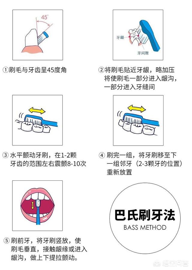 牙垢:牙垢图片 用什么方法可以去除黄牙？