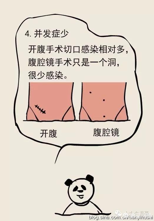 头条问答 - 在一个内行人看来,阑尾炎的手术的重点在哪里?(2个回答)