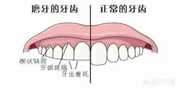 为什么会磨牙:猪为啥总是磨牙？是什么原因引起的？