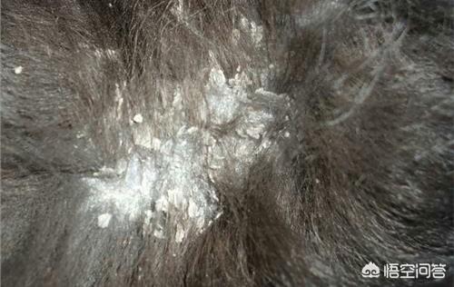 头屑头痒(头屑头痒掉发严重是什么问题?)