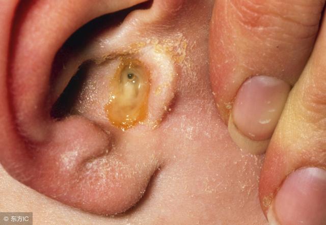 怎么样掏耳朵最干净，经常掏耳朵会对耳朵有伤害吗