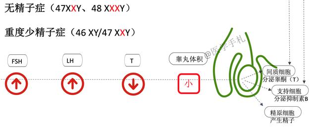 歌舞伎脸谱综合征:除了渐冻人症（ALS），还有哪些罕见病？
