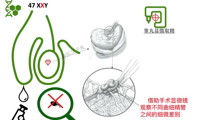 歌舞伎脸谱综合征:除了渐冻人症（ALS），还有哪些罕见病？
