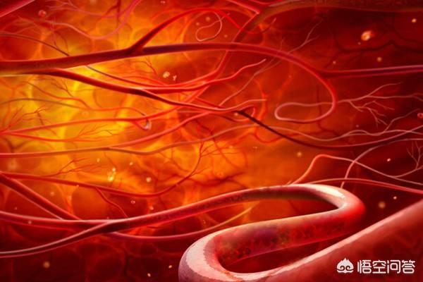 瘫痪是什么意思:我爸现在半边瘫痪了，是哪种类型的病？