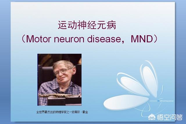 霍金帕金森:2032年霍金还会活着吗