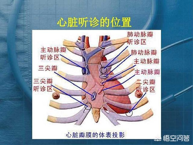 头条问答 - 如今的大夫还听心音吗?(5个回答)