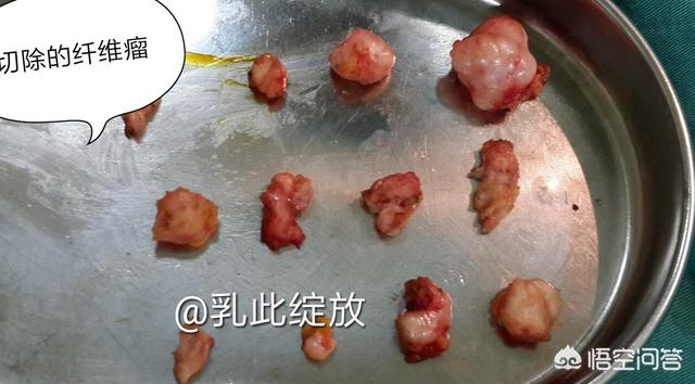 乳房蜂窝组织炎图片:胸痛是一个什么病，为什么现在去医院总能看到“胸痛患者优先”？
