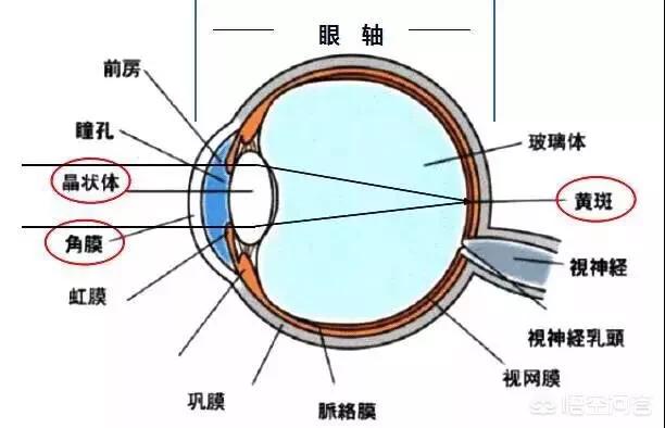 可以把晶状体里的房水抽出来一点,通过释压慢慢缓解近视,甚至恢复视力吗？
