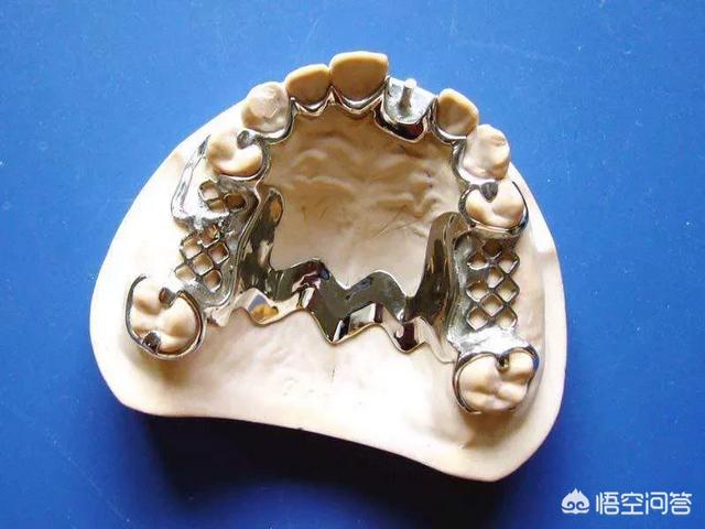 头条问答 - 什么是树脂牙,什么样牙齿能安装树脂牙齿?(5个回答)