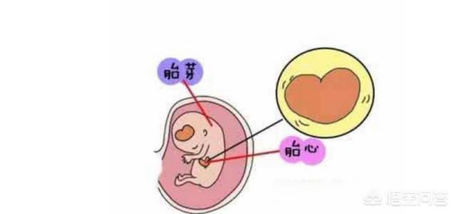仍然看不见胎心胎芽怎么办，怀孕46天左右看不到胎芽胎心该怎么办