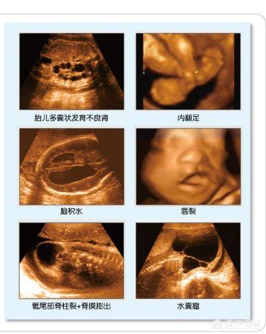头条问答 - 如何通过宝宝四维照片判断孩子的健康?(11个回答)