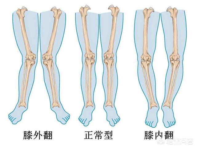 佝偻病的早期症状:一岁宝宝半夜准时哭是为什么？