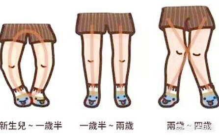 佝偻病的早期症状:一岁宝宝半夜准时哭是为什么？