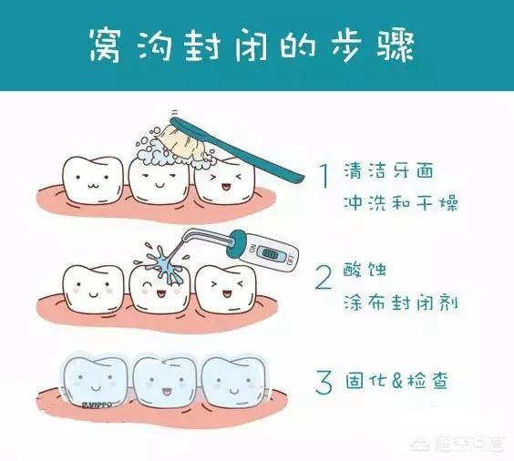 怎么预防龋齿的发生，怎么才能防止蛀牙继续腐蚀