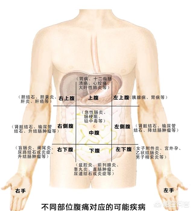 原发性腹膜炎:胃痛和腹痛的区别是什么？