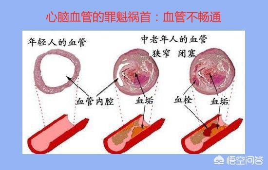 丹参茶有什么功效什么样的人喝好,丹参泡水对心血管有什么作用？