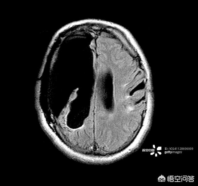 苹果事件:得知孟晚舟未能获释的消息，把苹果手机砸了，换华为，有啥推荐