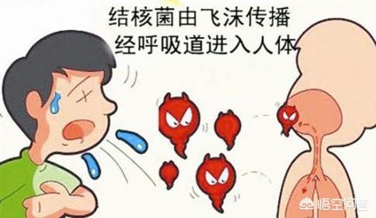 肺炎会传染吗:朋友的孩子得了肺炎，朋友会传染给别人吗？