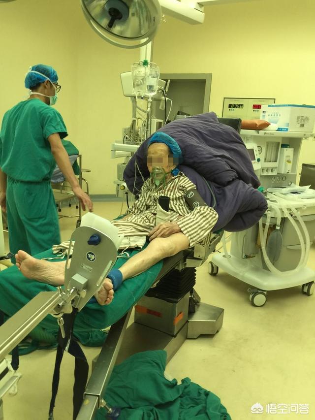 头条问答 - 老年人疝气手术可以全麻吗?(6个回答)