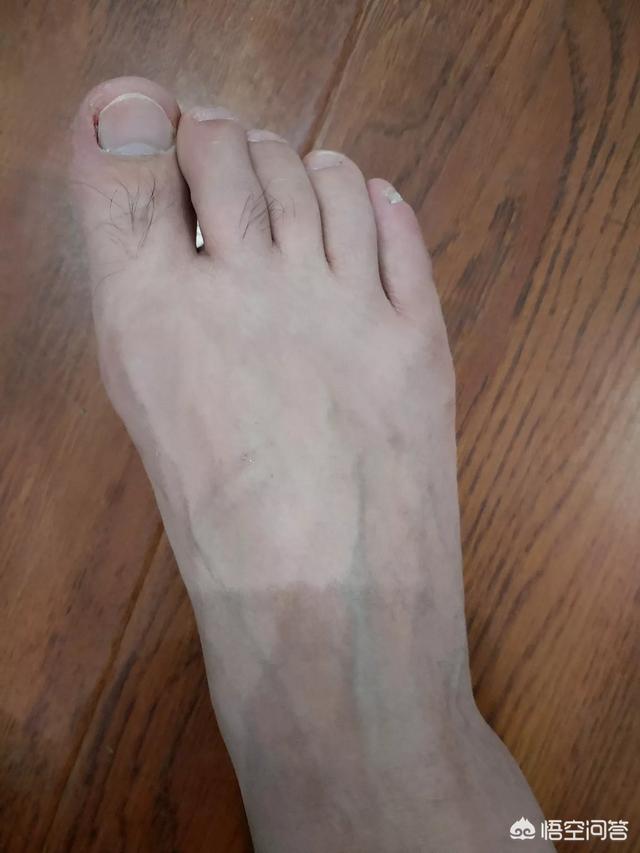 头条问答 男人的脚什么样的好看 4个回答
