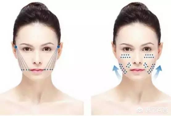 怎样去除皱纹,哪些方法可以去除皱纹呢？