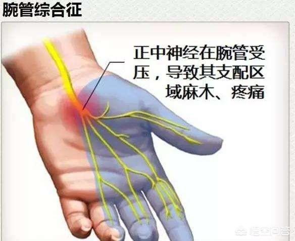 头条问答 手腕处腱鞘炎有什么好的治疗方法 医学小侦探的回答 0赞