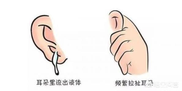 腭裂宝宝中耳炎怎么办:孩子得了中耳炎，该怎么办？