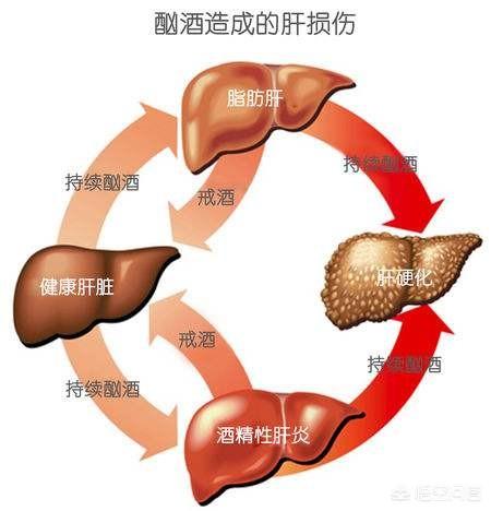 头条问答 - 脂肪肝跟酒精肝都是一样的吗?(10个回答)