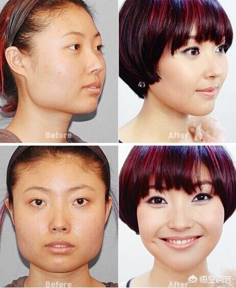 瘦咬肌瘦咬肌