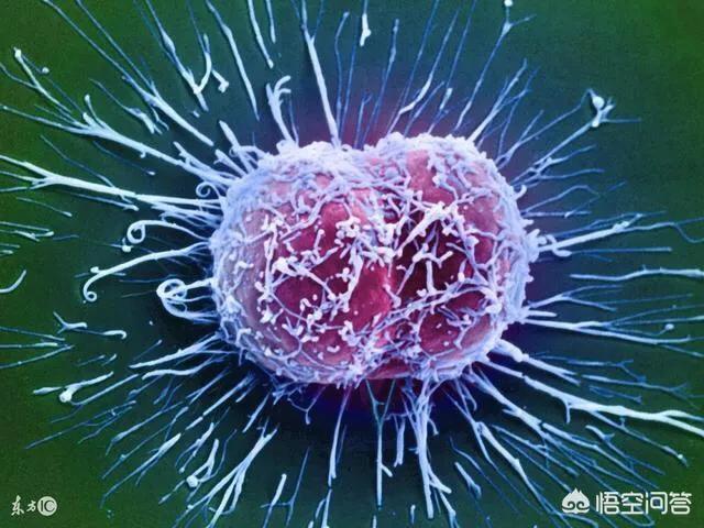 徐婷癌症:澳大利亚宣布战胜癌症是真是假？