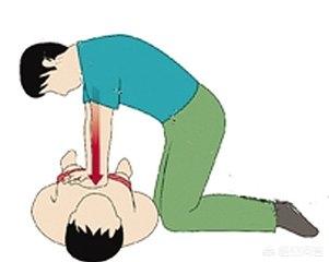 李艾佳:36岁女演员李艾佳突发疾病死亡，面对突发性疾病怎样采取急救