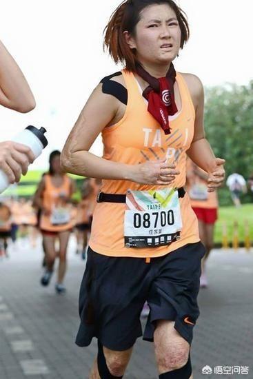 任家萱烧伤前后对比照:在娱乐圈内，胡歌和俞灏明车祸复出后，为何差距如此大