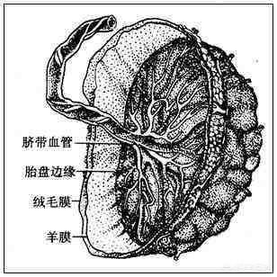 头条问答 - 怀孕四个月说是球拍状胎盘,什么意思?