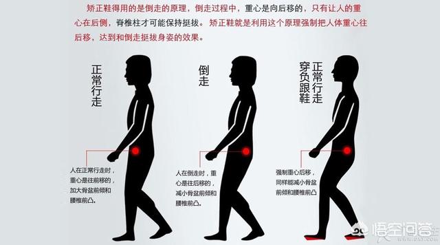 倒走两月腰突居然好了可靠吗，倒退着走对治疗腰腿痛有作用吗？