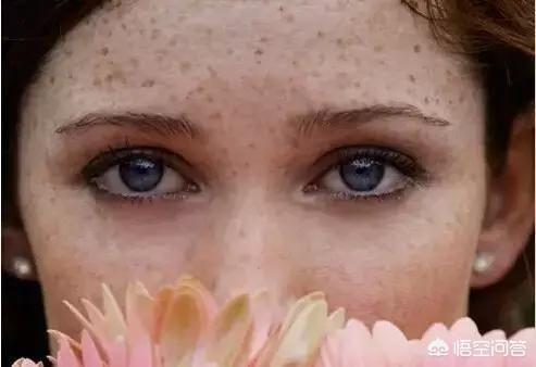 排毒祛斑(女人有斑吃什么东西最排毒祛斑)