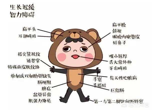 头条问答 - 两个孩子,儿子10岁唐氏综合症残疾,4岁女儿正常,离婚两个