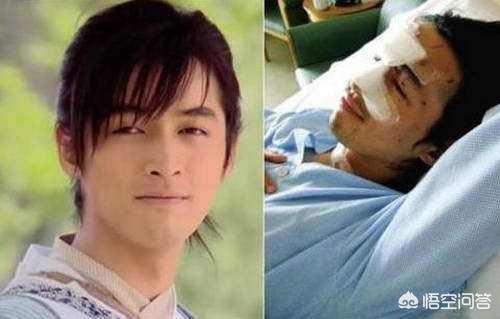 于海丹:癌症五年不复发就算治好了吗