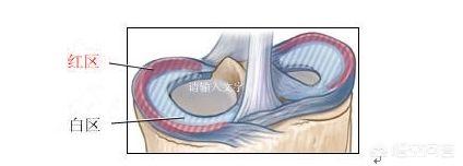 半月板损伤症状:半月板损伤症状与滑膜炎有啥区别 如何自测是不是半月板损伤？