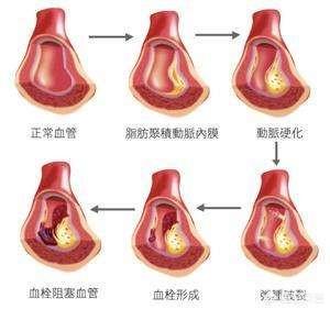 丹参茶有什么功效什么样的人喝好,丹参泡水对心血管有什么作用？